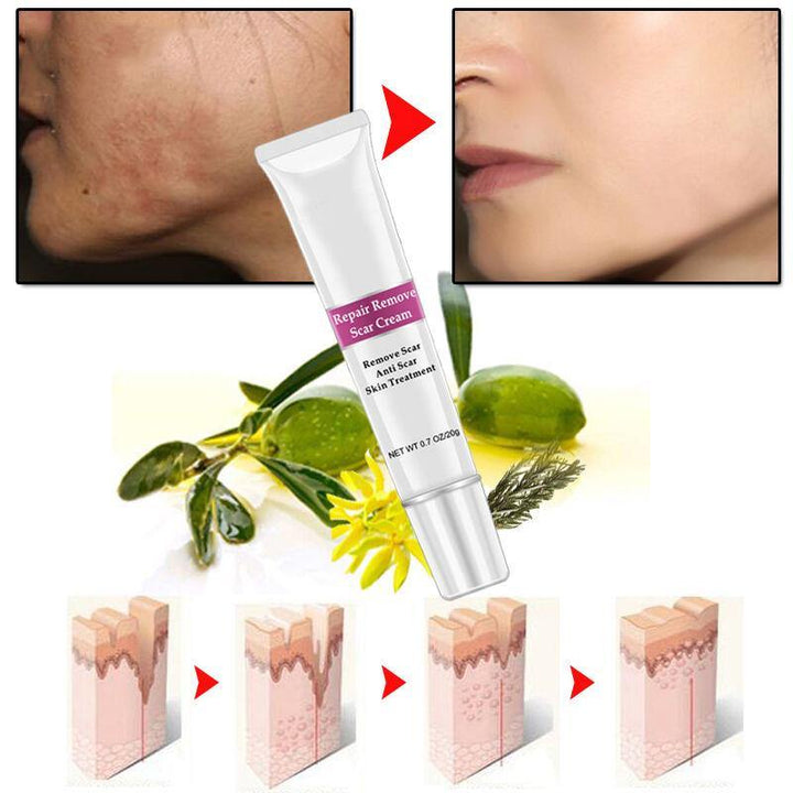 RtopR Facial Body Scar Removal Cream Repair Skin Weaken Marks Eliminate Pimple Promote Horny Layer Updating