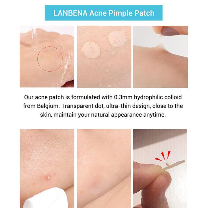 LANBENA Tea Tree Daily Acne Stickers + Night acne Stickers Fade Blackhead Acne Remover