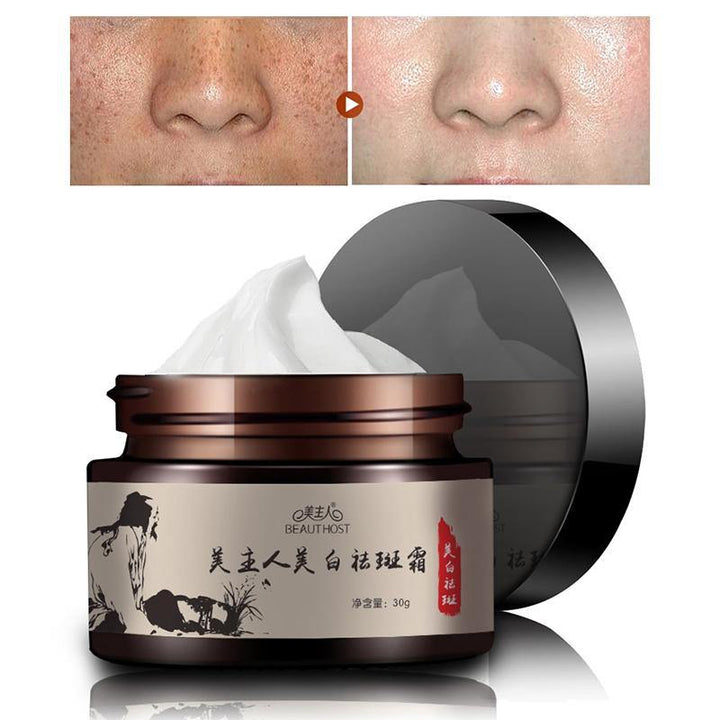 30g Freckle Cream Remove Sunburn Freckles Facial Cream (01#)