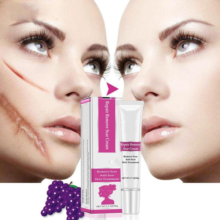 RtopR Facial Body Scar Removal Cream Repair Skin Weaken Marks Eliminate Pimple Promote Horny Layer Updating