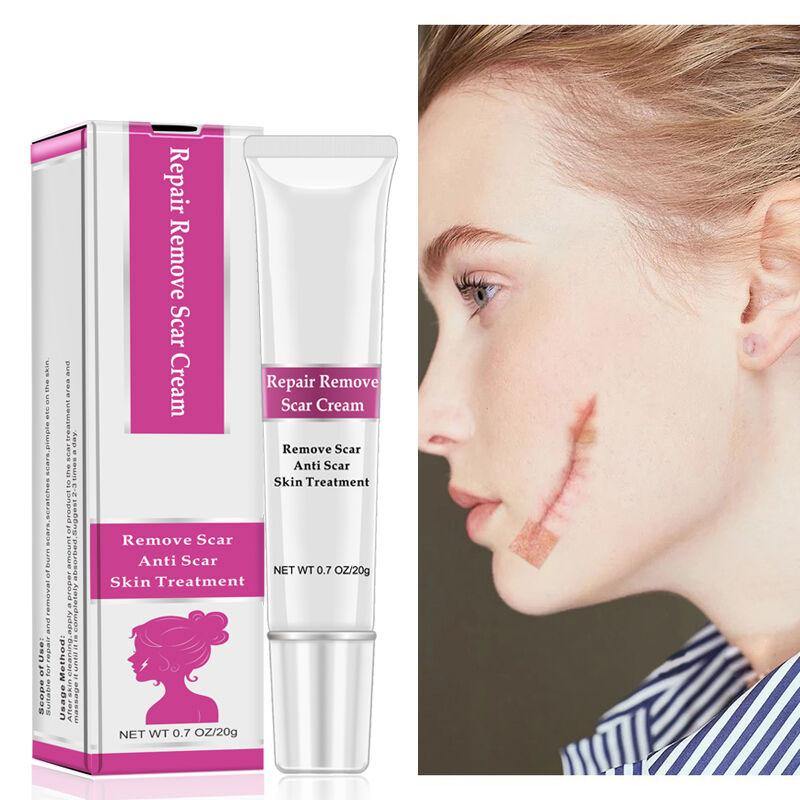 RtopR Facial Body Scar Removal Cream Repair Skin Weaken Marks Eliminate Pimple Promote Horny Layer Updating