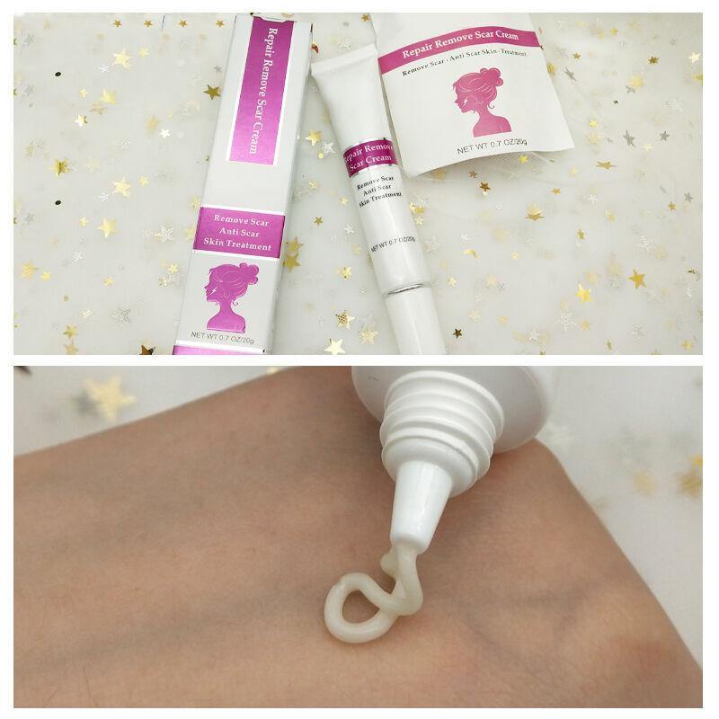 RtopR Facial Body Scar Removal Cream Repair Skin Weaken Marks Eliminate Pimple Promote Horny Layer Updating