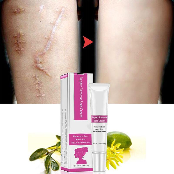 RtopR Facial Body Scar Removal Cream Repair Skin Weaken Marks Eliminate Pimple Promote Horny Layer Updating